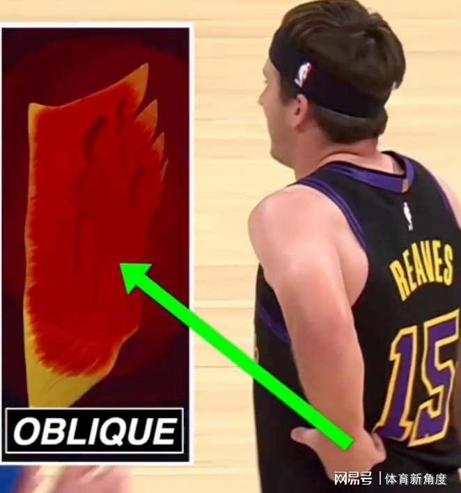  NBA球员为何舍近求远？欧洲运动医学的隐秘优势与争议 体育新闻